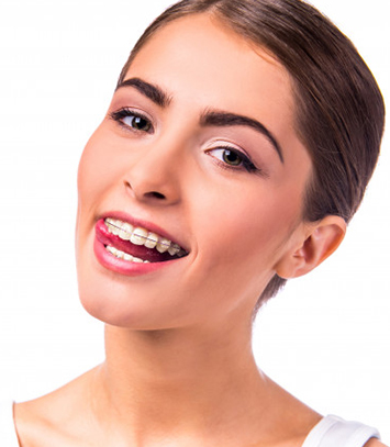 What Can You Expect During Treatment With Clear Braces